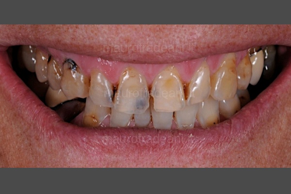 analisi-estetica-del-sorriso-dottor-mauro-fradeani-pesaro